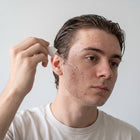 Homem aplicando o Serum Antiacne MAJOR com conta-gotas no rosto